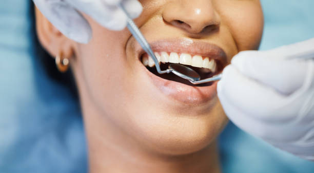 Best Emergency Treatment for Dental Infections or Abscesses in Oak Hill, OH